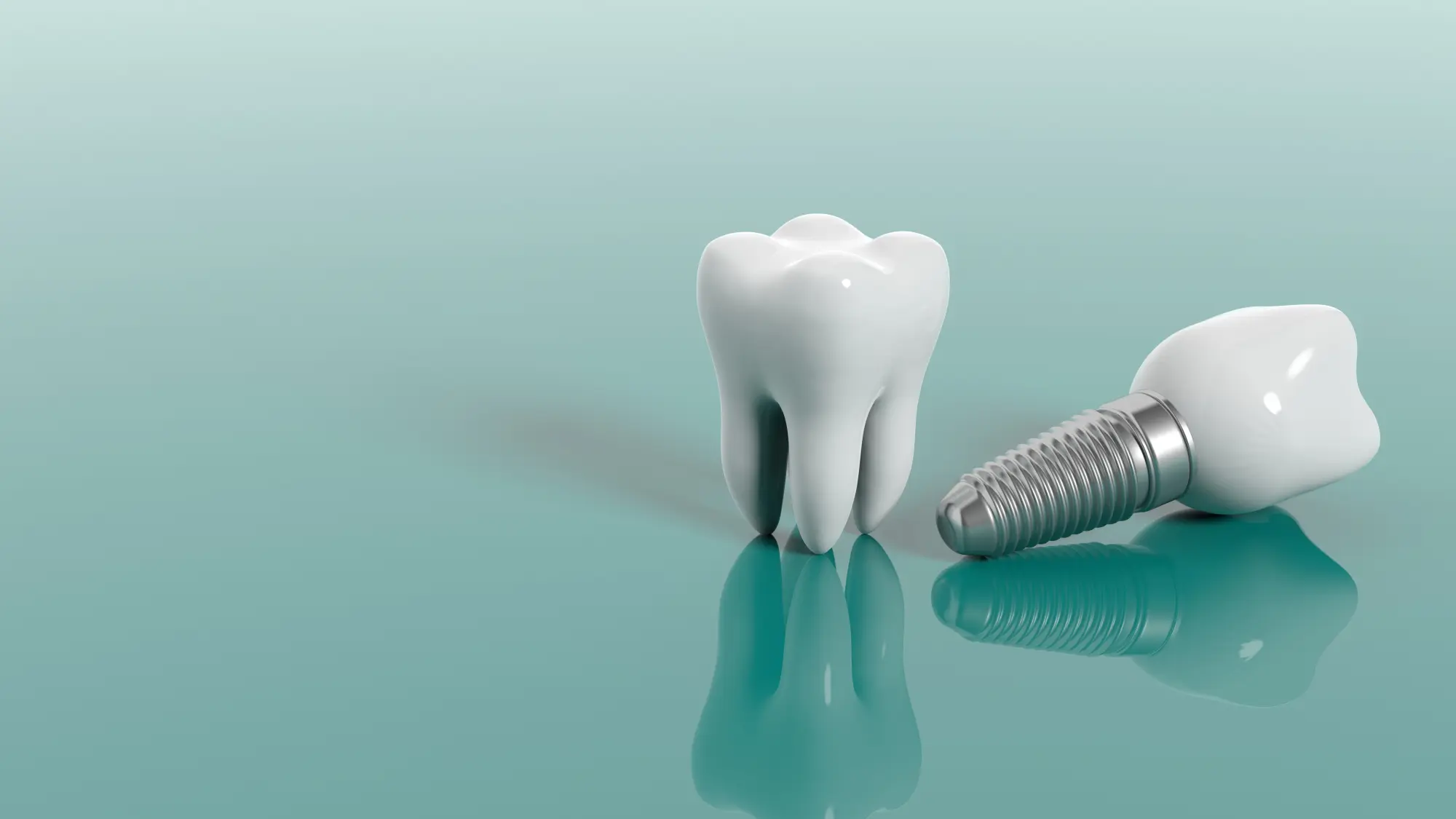 Single Tooth Missing? Why a Dental Implant Beats Other Options